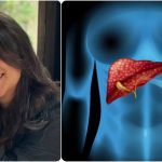 दीपिका कक्कड़ ने लीवर कैंसर को दी मात