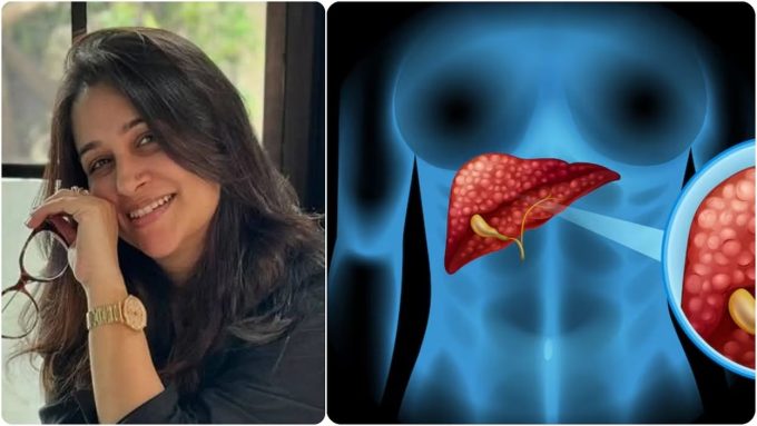 दीपिका कक्कड़ ने लीवर कैंसर को दी मात