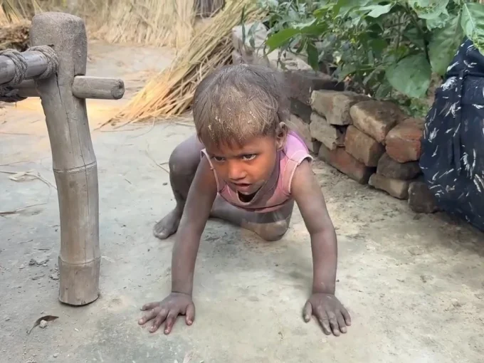 गाजीपुर के गांवों में तेज बुखार के बाद दिव्यांग हुए बच्चे, रहस्यमयी बीमारी से फैला डर