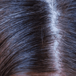 सफेद बाल